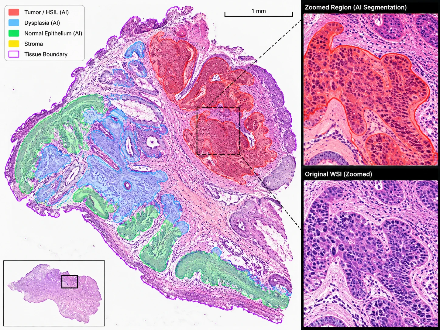 Pathology WSI